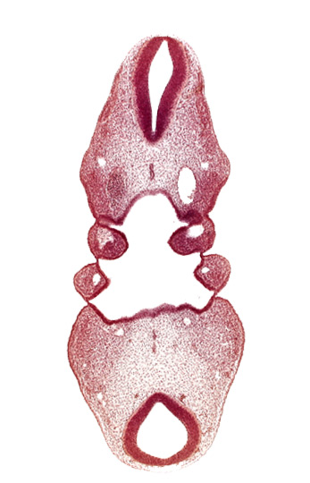 aortic arch 2, aortic arch 3, dermatomyotome 3 (O-3) , dermatomyotome 4 (O-4) , dorsal aorta, internal carotid artery, mesencoel (cerebral aqueduct), pharyngeal pouch 3, pharynx primordium, precardinal vein, primary head vein, region of mesencephalic (cephalic) flexure