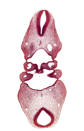 dermatomyotome 4 (O-4) , hypopharyngeal eminence of tongue, notochord, region of cervical flexure, region of mesencephalic (cephalic) flexure