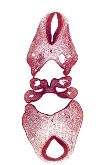 aortic arch 2, copula of tongue, dorsal aorta, notochord, pharyngeal arch 2, precardinal vein, region of mesencephalic (cephalic) flexure