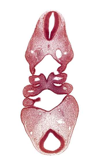 aortic arch 2, dermatomyotome 4 (O-4) , dorsal aorta, junction of rhombencephalon and spinal cord, mandibular prominence of pharyngeal arch 1, notochord, pharyngeal arch 2, pharyngeal pouch 1, precardinal vein, region of mesencephalic (cephalic) flexure