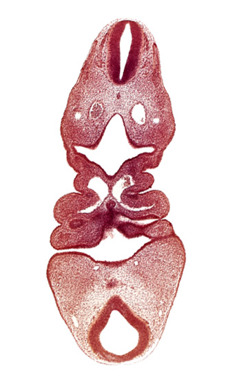 C-1 spinal ganglion primordium, adenohypophysial pouch, cervical sinus, dermatomyotome 5 (C-1), edge of mamillary recess, epicardial ridge, epipharyngeal placode 4, internal carotid artery, mesencephalon, pharyngeal arch 3, pharyngeal arch 4, pharyngeal pouch 1