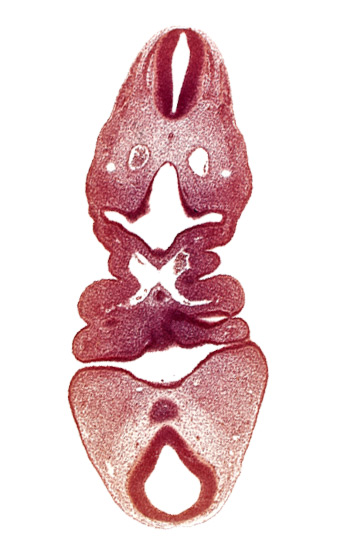 aortic arch 2, aortic sac, caudal edge of thyroid diverticulum, dermatomyotome 5 (C-1), dorsal aorta, internal carotid artery, lateral tongue eminence, mamillary recess, median tongue eminence, mesencephalon, oral fissure, pharyngeal arch 3, pharyngeal pouch 4, pharynx primordium