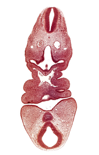 aortic arch 4, aortic sac, cervical sinus, dermatomyotome 5 (C-1), dorsal aorta, internal carotid artery, mamillary recess, mandibular prominence of pharyngeal arch 1, maxillary prominence of pharyngeal arch 1, mesencephalon, pharyngeal arch 2, pharyngeal pouch 1