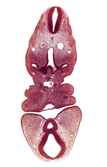 caudal edge of pharyngeal pouch 1, cervical sinus, dermatomyotome 5 (C-1), dorsal aorta, junction of aortic sac and truncus arteriosus, junction of diencephalon and mesencephalon, mamillary recess, mesencephalon, precardinal vein