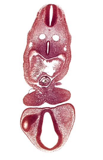 C-1 spinal ganglion primordium, caudal edge of pharyngeal arch 2, dermatomyotome 5 (C-1), dermatomyotome 6 (C-2), dorsal aorta, dorsal thalamus (diencephalon), left atrium, mandibular prominence of pharyngeal arch 1, optic vesicle, pericardial cavity, prosencoel (third ventricle), tracheo-esophageal tube, truncus arteriosus