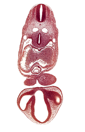 C-2 spinal ganglion primordium, chiasmatic part of diencephalon, dermatomyotome 6 (C-2), dorsal aorta, dorsal thalamus, endocardium, epicardial ridge, epithalamus, gelatinous reticulum, interatrial foramen (primum), intraretinal space (optic vesicle cavity), left atrium, mandibular prominence of pharyngeal arch 1, marginal layer of spinal cord, median mandibular groove, notochord, optic stalk (CN II), optic vesicle, pericardial cavity, precardinal vein, prosencoel (third ventricle), right atrium, sclerotome, stomodeum, tracheo-esophageal tube, truncus arteriosus, ventral thalamus