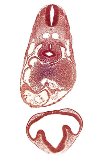 C-2 spinal ganglion primordium, blood cells in left atrium, conus cordis, dermatomyotome 6 (C-2), diencephalon, endocardium, epimyocardium, esophagus primordium, intraretinal space (optic vesicle cavity), mesocardium, notochord, optic part of retina, optic stalk (CN II), ostium primum, pericardial cavity, pericardial sac, pericardioperitoneal canal (pleural cavity), precardinal vein, prosencoel (third ventricle), right aorta, right atrium, right lung bud, sinus venosus