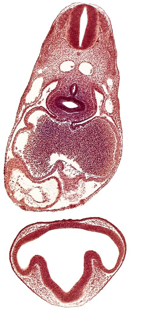 C-2 spinal ganglion primordium, caudal edge of tracheo-esophageal septum, common cardinal vein, conus cordis: endocardium, conus cordis: epimyocardium, conus cordis: gelatinous reticulum, dermatomyotome 6 (C-2), intraretinal space (optic vesicle cavity), left atrium, left lung bud, lens disc, mesocardium, notochord, optic evagination, optic part of retina, optic stalk (CN II), ostium primum, pericardioperitoneal canal (pleural cavity), postcardinal vein, primary interatrial septum (septum primum), prosencoel (third ventricle), sclerotome, sinu-atrial foramen, trachea primordium, ventral thalamus (diencephalon)