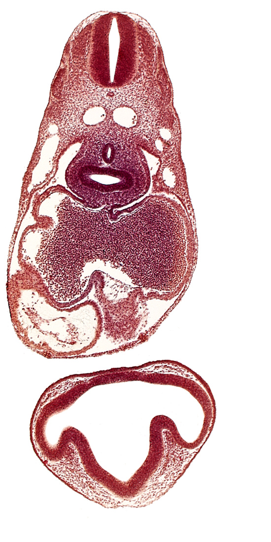 common cardinal vein, conus cordis: endocardium, conus cordis: epimyocardium, conus cordis: gelatinous reticulum, dermatomyotome 6 (C-2), dermatomyotome 7 (C-3), intraretinal space (optic vesicle cavity), left aorta, left atrium, left lung bud, lens disc, mesocardium, notochord, optic evagination, optic part of retina, pericardial cavity, pericardioperitoneal canal (pleural cavity), postcardinal vein, prosencoel (third ventricle), right atrium, right lung bud, sclerotome, sinu-atrial foramen, sinus venosus, trachea primordium, ventral thalamus (diencephalon)