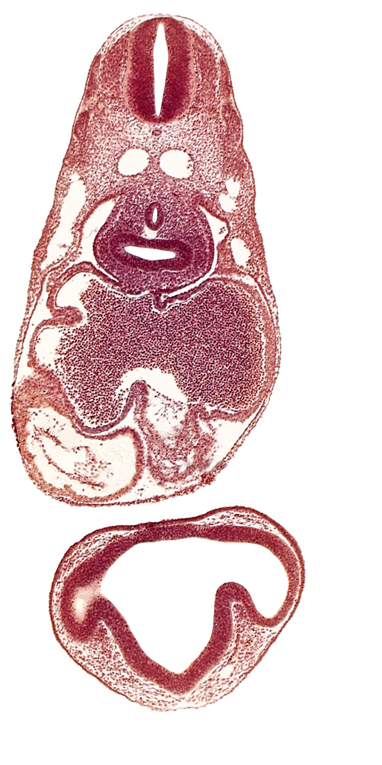 common cardinal vein, conus cordis: endocardium, conus cordis: epimyocardium, conus cordis: gelatinous reticulum, dermatomyotome 6 (C-2), dermatomyotome 7 (C-3), intraretinal space (optic vesicle cavity), left atrium, notochord, optic part of retina, pericardial cavity, pericardioperitoneal canal (pleural cavity), postcardinal vein, prosencoel (third ventricle), right atrium, right lung bud, sinus venosus, trachea primordium, ventral thalamus (diencephalon)