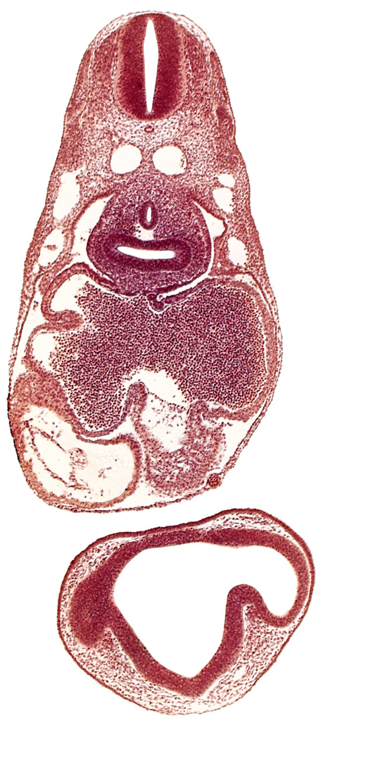 caudal edge of optic vesicle, common atrioventricular canal, common cardinal vein, dermatomyotome 6 (C-2), dermatomyotome 7 (C-3), esophagus primordium, left atrium, notochord, optic part of retina, pericardial cavity, pericardioperitoneal canal (pleural cavity), postcardinal vein, primary interatrial septum (septum primum), prosencoel (third ventricle), right atrium, right lung bud, sinus venosus, ventral thalamus (diencephalon)