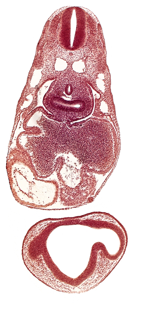 caudal edge of optic vesicle, common atrioventricular canal, common cardinal vein, dermatomyotome 7 (C-3), epimyocardium, esophagus primordium, gelatinous reticulum, intraretinal space (optic vesicle cavity), left atrium, notochord, optic part of retina, pericardial cavity, pericardioperitoneal canal (pleural cavity), postcardinal vein, primary interatrial septum (septum primum), prosencoel (third ventricle), right atrium, right lung bud, sinus venosus, ventral thalamus (diencephalon)