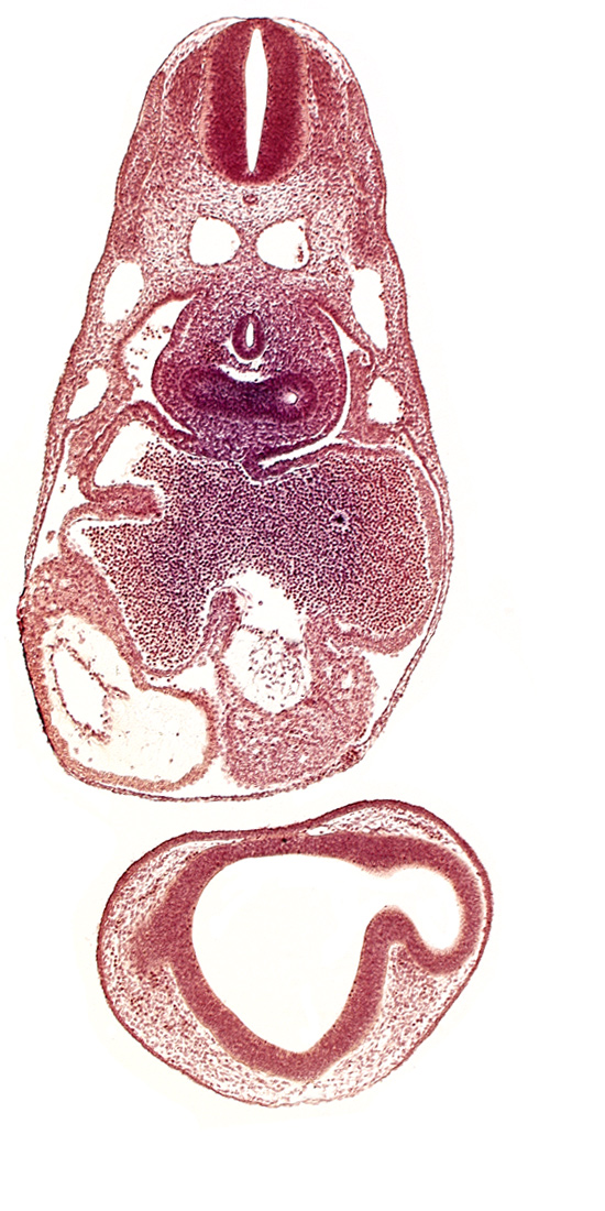 common atrioventricular canal, common cardinal vein, dermatomyotome 7 (C-3), epimyocardium, esophagus primordium, intraretinal space (optic vesicle cavity), left atrium, left lung bud, notochord, pericardial cavity, pericardioperitoneal canal (pleural cavity), postcardinal vein, primary interatrial septum (septum primum), prosencoel (third ventricle), right atrium, right lung bud, sinus venosus, ventral thalamus (diencephalon)