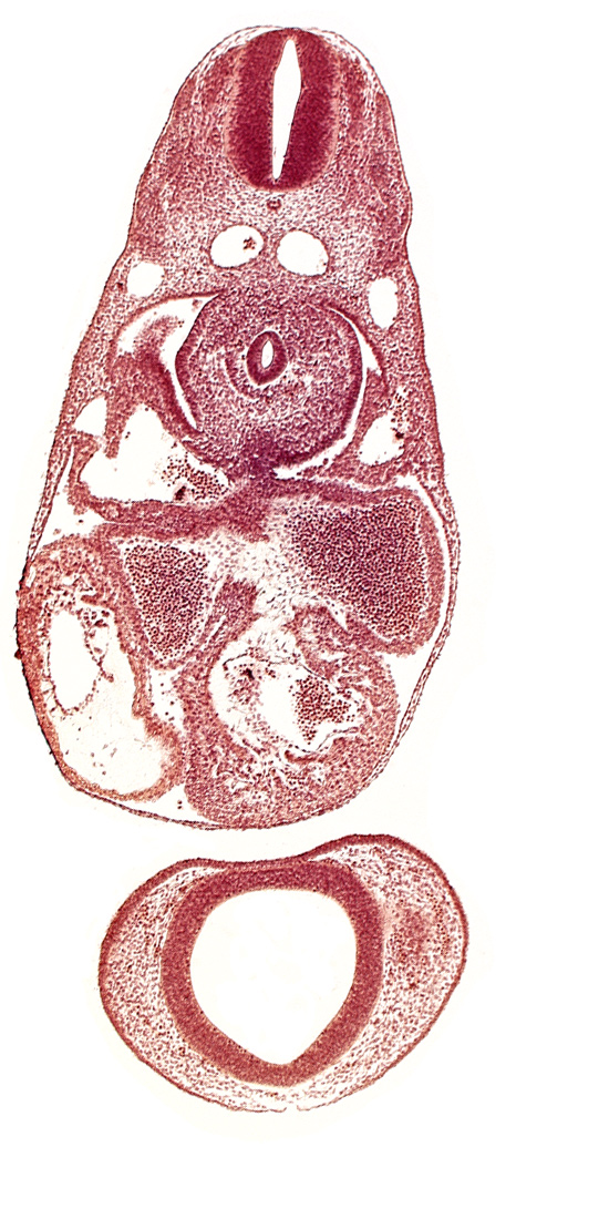 C-3 spinal ganglion primordium, anterior cerebral plexus, common atrioventricular canal (isthmus), common cardinal vein, dermatomyotome 7 (C-3), dorsal aorta, endocardium, epimyocardium, esophagus primordium, interventricular sulcus, left atrium, notochord, postcardinal vein, prosencephalon (telencephalic part), prosencoel (third ventricle), trabecular part of left ventricle