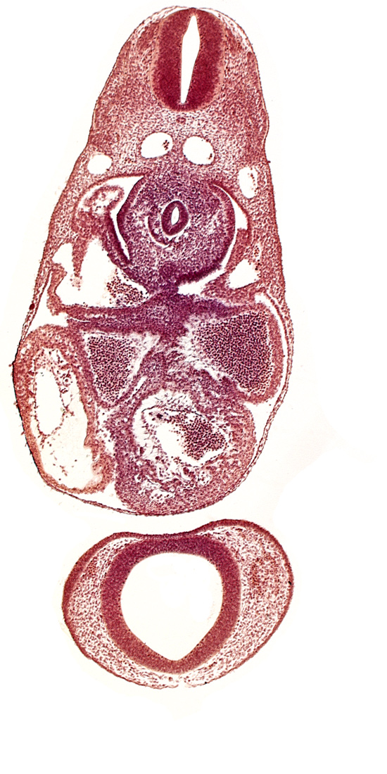 C-3 spinal ganglion primordium, anterior cerebral plexus, common cardinal vein, dermatomyotome 7 (C-3), dorsal aorta, endocardium, epimyocardium, interventricular sulcus, left atrium, notochord, postcardinal vein, prosencephalon (telencephalic part), prosencoel (third ventricle), trabecular part of left ventricle