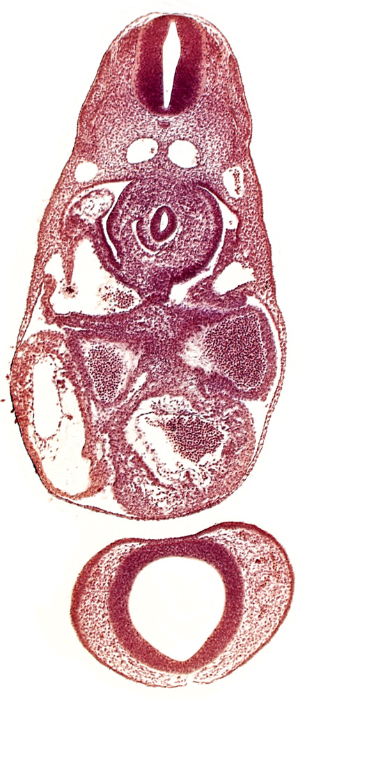 C-3 spinal ganglion primordium, common cardinal vein, dermatomyotome 7 (C-3), dorsal aorta, endocardium, epimyocardium, interventricular sulcus, left atrium, notochord, postcardinal vein, prosencephalon (telencephalic part), prosencoel (third ventricle), right atrium, sinus venosus, trabecular part of left ventricle