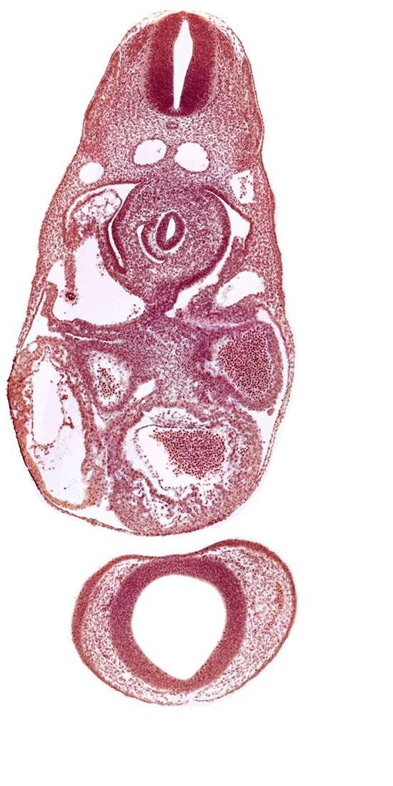 C-3 spinal ganglion primordium, dermatomyotome 7 (C-3), dorsal aorta, endocardium, left atrium, left common cardinal vein, notochord, postcardinal vein, prosencephalon (telencephalic part), prosencoel (third ventricle), right atrium, sinus venosus, trabecular part of left ventricle