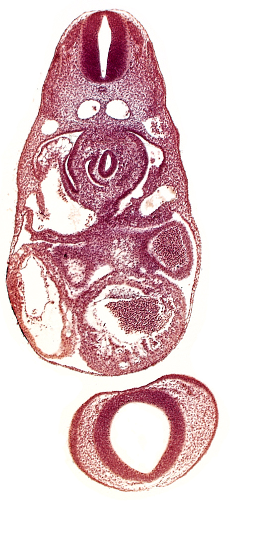 C-3 spinal ganglion primordium, dermatomyotome 7 (C-3), dorsal aorta, endocardium, left atrium, left common cardinal vein, lesser sac, notochord, postcardinal vein, prosencephalon (telencephalic part), prosencoel (third ventricle), sinus venosus, trabecular part of left ventricle