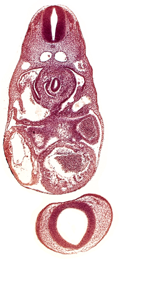 C-3 spinal ganglion primordium, dermatomyotome 7 (C-3), dorsal aorta, endocardium, left atrium, left common cardinal vein, lesser  sac, notochord, postcardinal vein, prosencephalon (telencephalic part), prosencoel (third ventricle), sinus venosus, trabecular part of left ventricle