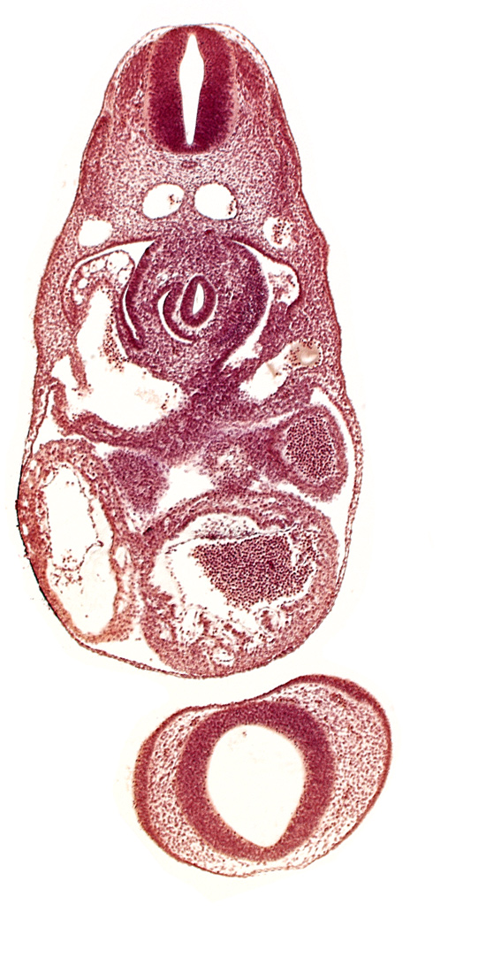 C-3 spinal ganglion primordium, dermatomyotome 7 (C-3), dorsal aorta, endocardium, junction of left common cardinal and left umbilical veins with left sinus horn, junction of right hepatocardiac vein and sinus venosus, nasal disc (olfactory placode), notochord, postcardinal vein, prosencephalon (telencephalic part), prosencoel (third ventricle), trabecular part of left ventricle