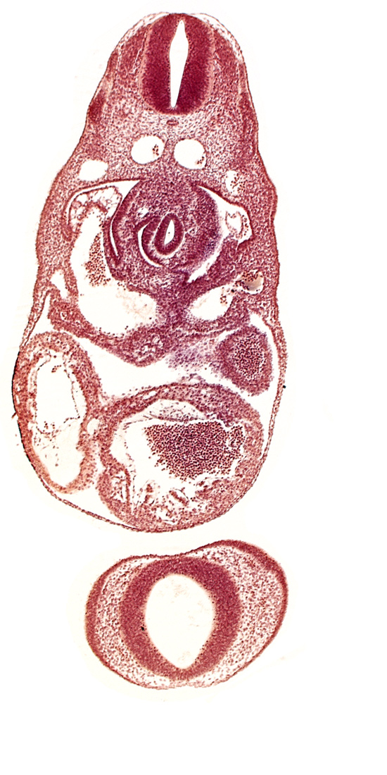 C-3 spinal ganglion primordium, dorsal aorta, left ventricle, nasal disc (olfactory placode), notochord, postcardinal vein, prosencephalon (telencephalic part), prosencoel (third ventricle), sinus venosus, stomach primordium