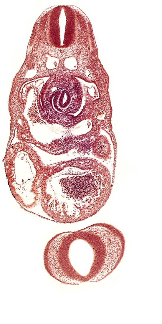 C-3 spinal ganglion primordium, dorsal aorta, junction of left common cardinal vein and sinus venosus, left ventricle, nasal disc (olfactory placode), notochord, postcardinal vein, prosencephalon (telencephalic part), prosencoel (third ventricle), sinus venosus, stomach primordium