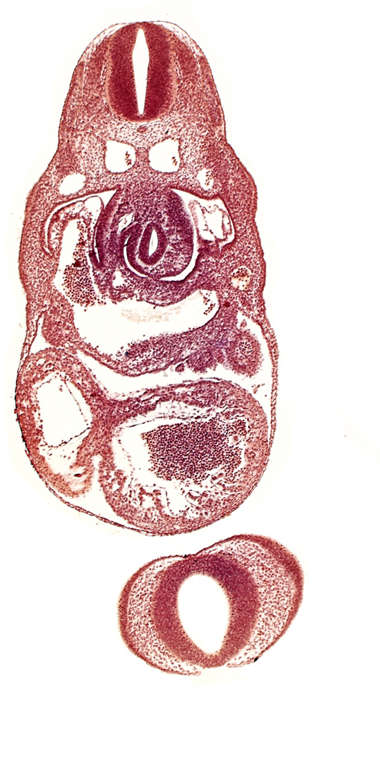 C-3 spinal ganglion primordium, endocardium, junction of left common cardinal vein and sinus venosus, left ventricle, nasal disc (olfactory placode), notochord, pericardial cavity, postcardinal vein, prosencephalon (telencephalic part), prosencoel (third ventricle), sinus venosus, stomach primordium
