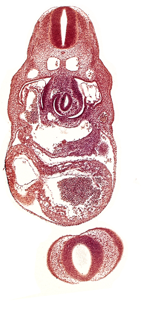 C-3 spinal ganglion primordium, caudal edge of left atrium, dermatomyotome 8 (C-4), dorsal aorta, left ventricle, nasal disc (olfactory placode), notochord, pericardial cavity, postcardinal vein, prosencephalon (telencephalic part), prosencoel (third ventricle), sinus venosus, stomach primordium