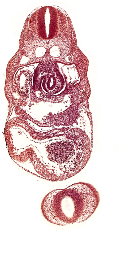 C-4 spinal ganglion primordium, anterior interventricular sulcus, cephalic edge of upper limb bud, dermatomyotome 8 (C-4), dorsal aorta, endocardium, epimyocardium, interventricular foramen, junction of hepatocardiac and umbilical veins, left horn of sinus venosus, left umbilical vein, nasal disc (olfactory placode), notochord, postcardinal vein, posterior interventricular sulcus, prosencoel (third ventricle), stomach primordium, telencephalon medium