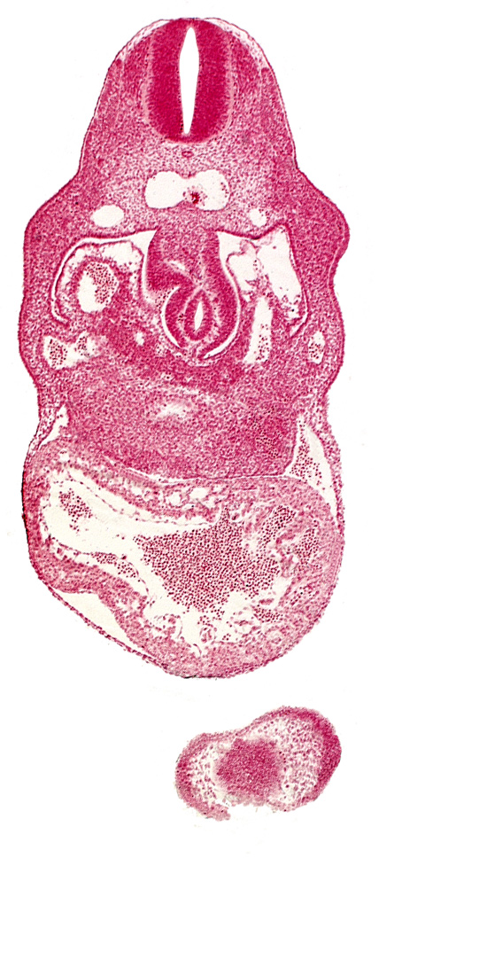 anterior interventricular sulcus, caudal edge of sinus venosus, dermatomyotome 8 (C-4), hepatic lamina(e), hepatic sinusoid, hepatocardiac vein, interventricular foramen, junction of left and right dorsal aortas, lamina terminalis of prosencephalon, nasal disc (olfactory placode), notochord, right umbilical vein, upper limb bud