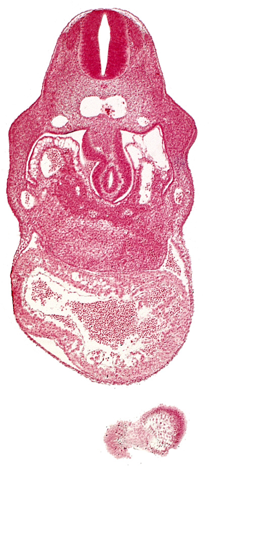 anterior interventricular sulcus, cephalic part of head, hepatic lamina(e), hepatic sinusoid, hepatocardiac vein, notochord, right umbilical vein, united dorsal aortas, upper limb bud