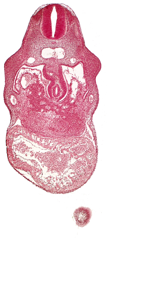 anterior interventricular sulcus, edge of head, hepatic lamina(e), hepatic sinusoid, hepatocardiac vein, left umbilical vein, notochord, right umbilical vein, united dorsal aortas, upper limb bud