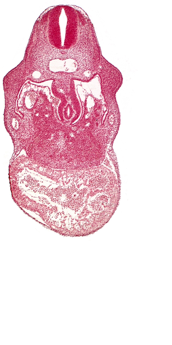 C-4 spinal ganglion primordium, anterior interventricular sulcus, coelomic cavity, dorsal mesogastrium, endocardium, hepatic sinusoid, hepatocardiac vein, left umbilical vein, notochord, postcardinal vein, primary interventricular foramen, right umbilical vein (involuting), stomach primordium, united dorsal aortas, upper limb bud, ventral mesogastrium