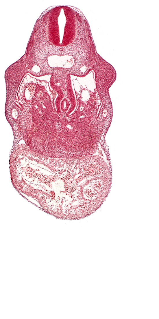 C-4 spinal ganglion primordium, anterior interventricular sulcus, coelomic cavity, dorsal mesogastrium, endocardium, hepatic lamina(e), hepatic sinusoid, hepatocardiac vein, left umbilical vein, notochord, postcardinal vein, primary interventricular foramen, right umbilical vein (involuting), stomach primordium, united dorsal aortas, upper limb bud, ventral mesogastrium