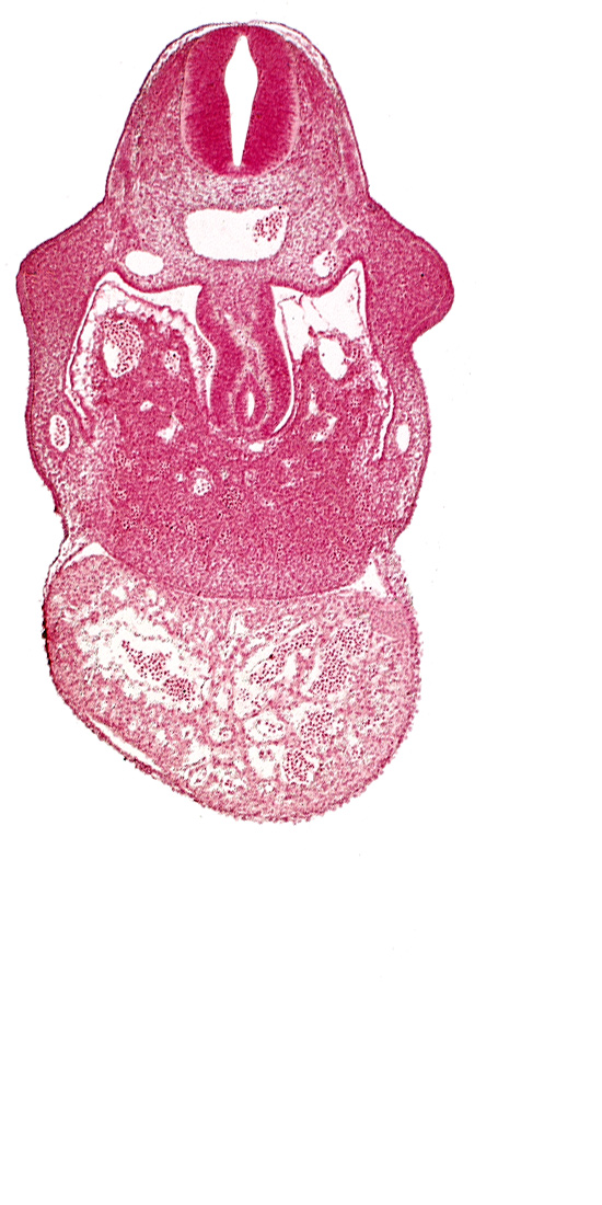 alar plate(s), basal plate, coelomic cavity, hepatic sinusoid, junction of duodenum and stomach primordia, left ventricle, pericardial cavity, postcardinal vein, right umbilical vein, right ventricle: endocardium, right ventricle: epimyocardium, septum transversum, specialized coelomic wall, upper limb bud