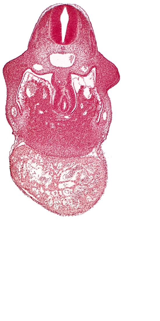 alar plate(s), basal plate, common aorta, duodenum primordium, hepatic lamina(e), hepatic sinusoid, left ventricle, notochord, postcardinal vein, right ventricle, septum transversum, specialized coelomic wall, upper limb bud