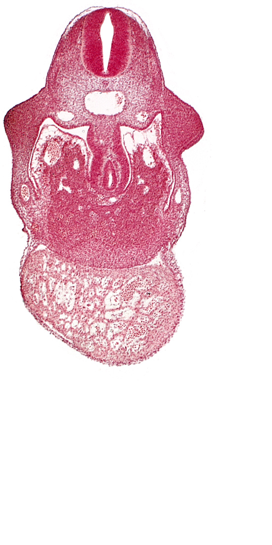 alar plate(s), basal plate, coelomic cavity, common aorta, duodenum primordium, hepatic lamina(e), hepatic sinusoid, notochord, postcardinal vein, septum transversum, specialized coelomic wall, upper limb bud