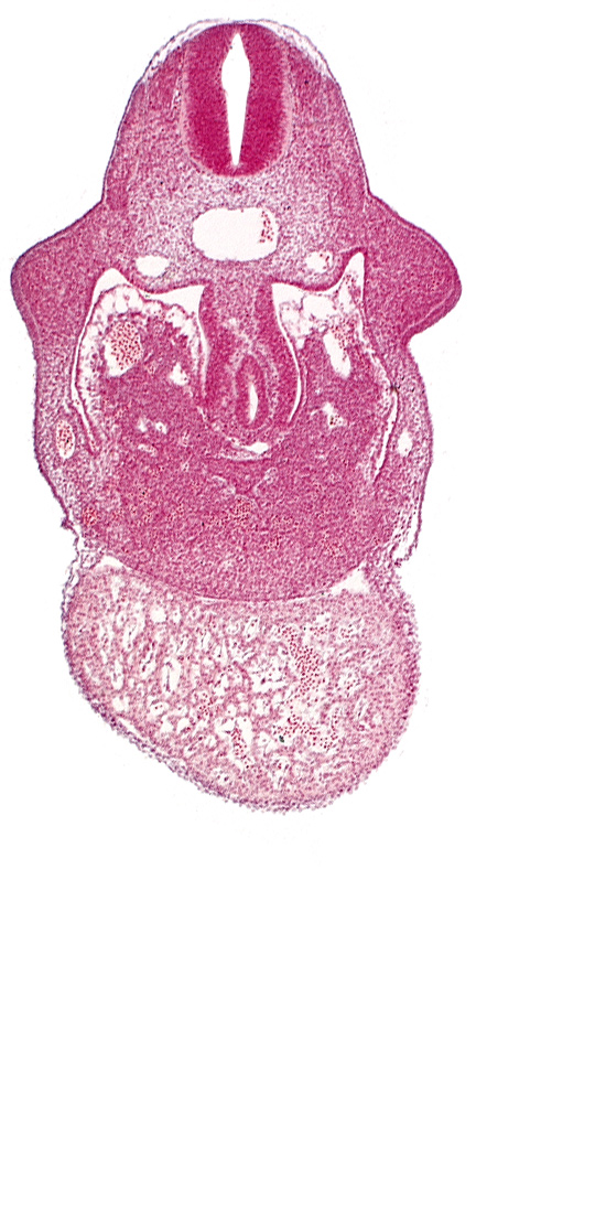 alar plate(s), basal plate, coelomic cavity, common aorta, duodenum primordium, hepatic lamina(e), hepatic sinusoid, notochord, postcardinal vein, septum transversum, specialized coelomic wall, upper limb bud