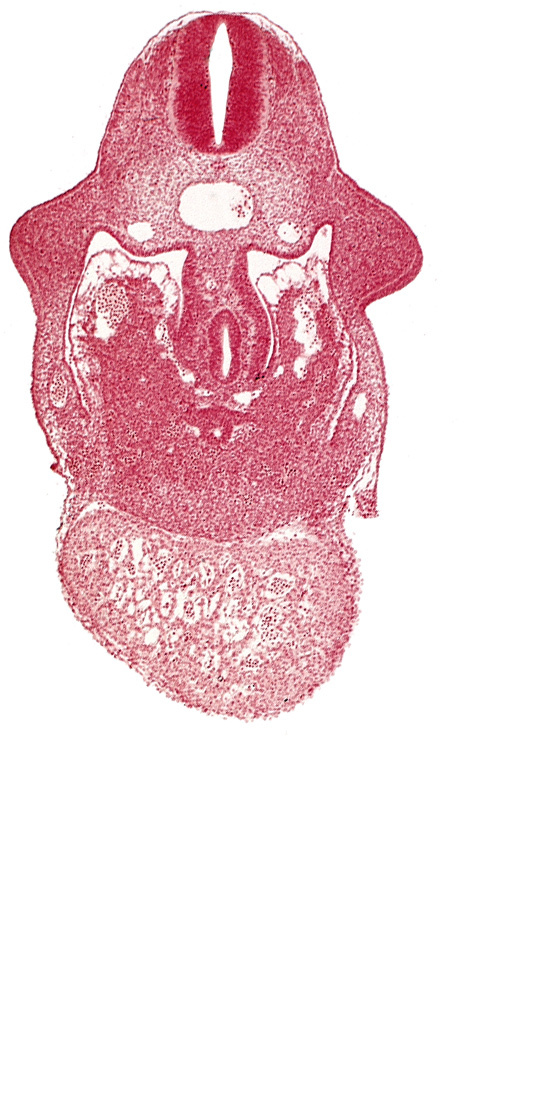 alar plate(s), basal plate, coelomic cavity, common aorta, common ventricle, dermatomyotome 9 (C-5), dorsal pancreatic bud, duodenum primordium, hepatic lamina(e), hepatocardiac vein, postcardinal vein, septum transversum, specialized coelomic wall, upper limb bud