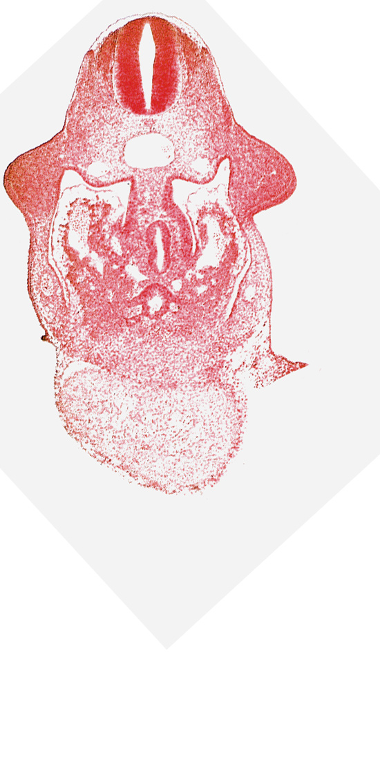 alar plate(s), amnion attachment, basal plate, coelomic cavity, common aorta, common ventricle, dorsal pancreatic bud, duodenum primordium, hepatic antrum, hepatocardiac vein, left umbilical vein, postcardinal vein, septum transversum, upper limb bud