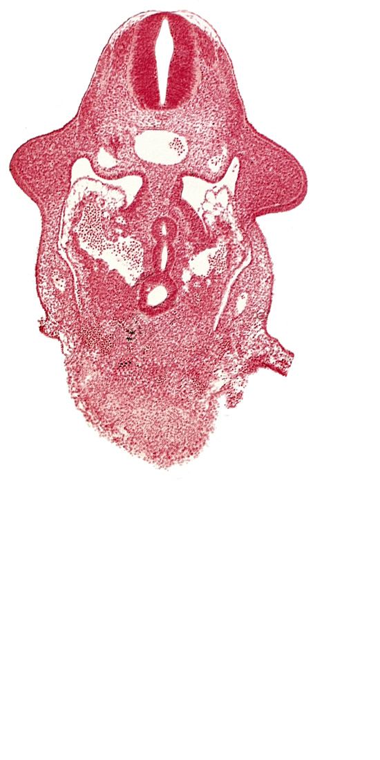 C-5 spinal ganglion primordium, amnion attachment, aorta, caudal edge of common ventricle, dermatomyotome 9 (C-5), dorsal pancreatic bud, hepatic antrum, left hepatocardiac vein, postcardinal vein, right hepatocardiac vein, septum transversum, specialized coelomic wall, upper limb bud