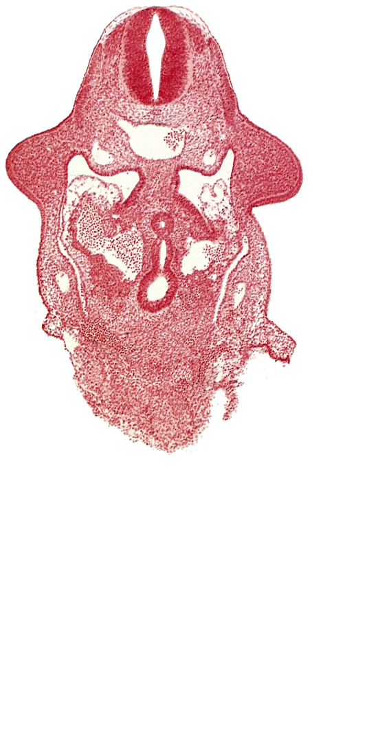 amnion attachment, aorta, caudal edge of common ventricle, dermatomyotome 9 (C-5), dorsal intersegmental artery, dorsal pancreatic bud, hepatic antrum, left hepatocardiac vein, notochord, postcardinal vein, right hepatocardiac vein, specialized coelomic wall, upper limb bud