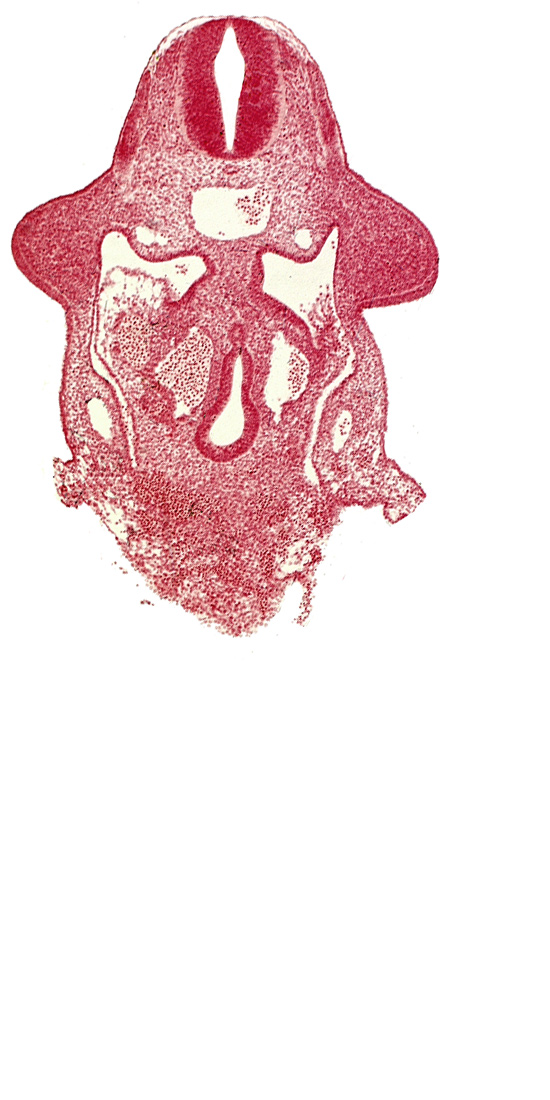 amnion attachment, aorta, apical ectodermal ridge, dermatomyotome 9 (C-5), dorsal pancreatic bud, duodenum primordium, hepatic antrum, marginal layer, neural tube, notochord, postcardinal vein, sulcus limitans, upper limb bud