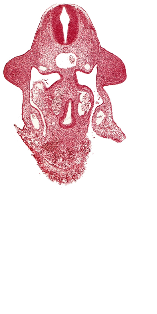 amnion attachment, aorta, apical ectodermal ridge, coelomic cavity, duodenum primordium, hepatic antrum, notochord, postcardinal vein, sulcus limitans, upper limb bud