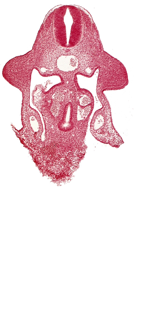 amnion attachment, aorta, apical ectodermal ridge, coelomic cavity, duodenum primordium, neural tube, postcardinal vein, sulcus limitans, upper limb bud