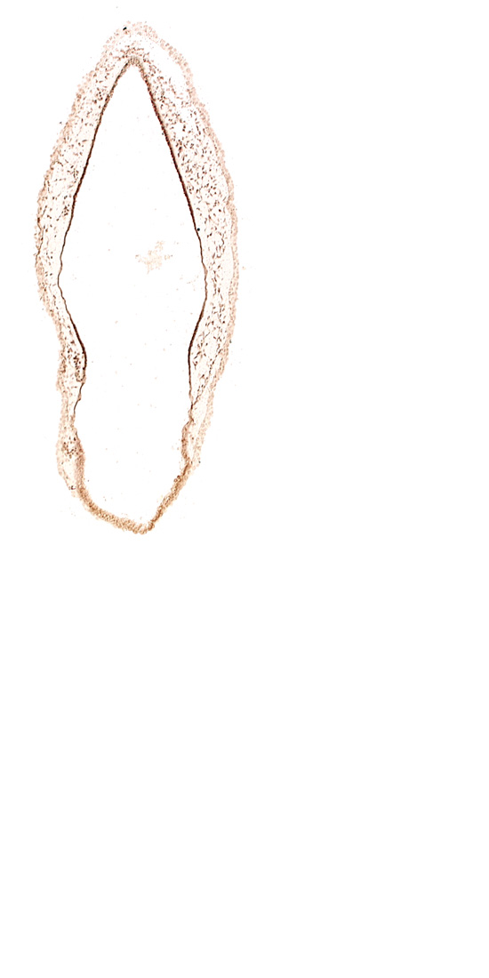 alar plate(s), head mesenchyme, rhombencoel (fourth ventricle), roof plate of rhombencephalon, surface ectoderm, venous plexus(es)