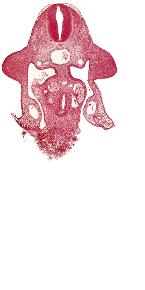 C-6 spinal ganglion primordium, amnion attachment, aorta, apical ectodermal ridge, coelomic cavity, communication of coelomic cavity with extra-embryonic coelom, dermatomyotome 10 (C-6), junction of hepatocardiac and right vitelline veins, left vitelline (omphalomesenteric) vein, neural tube, notochord, sclerotome, upper limb bud, ventral pancreatic bud