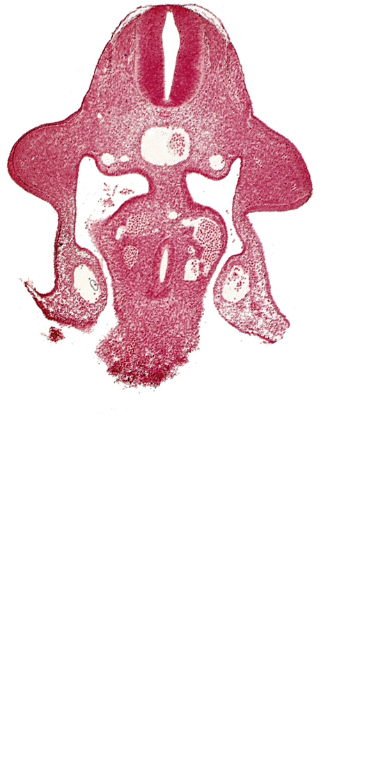 amnion attachment, aorta, coelomic cavity, communication of coelomic cavity with extra-embryonic coelom, duodenum primordium, junction of hepatocardiac and left vitelline veins, marginal layer, notochord, postcardinal vein, sulcus limitans, upper limb bud, vitelline (omphalomesenteric) vein