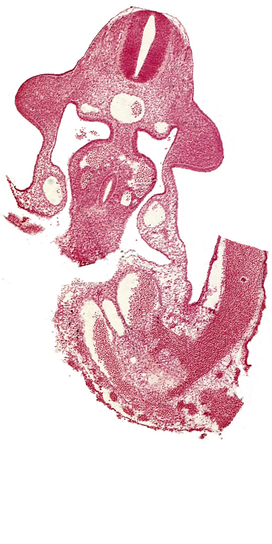 allantois, aorta, cephalic edge of umbilical vesicle stalk, coelomic cavity, communication between coelomic cavity and extra-embryonic coelom, dorsal mesentery, left umbilical artery, left umbilical vein, left vitelline (omphalomesenteric) vein, neural canal, postcardinal vein, right umbilical vein, umbilical cord, upper limb bud