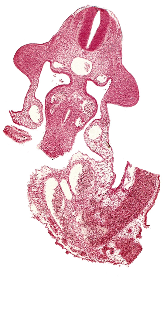 allantois, aorta, coelomic cavity, dorsal mesentery, left umbilical artery, left umbilical vein, left vitelline (omphalomesenteric) vein, neural tube, postcardinal vein, right umbilical artery, right umbilical vein, umbilical cord, upper limb bud